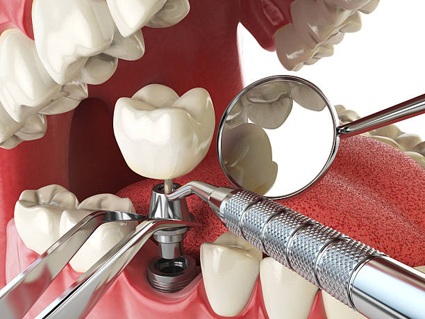 Trusted UT Emergency Dentist Experts
